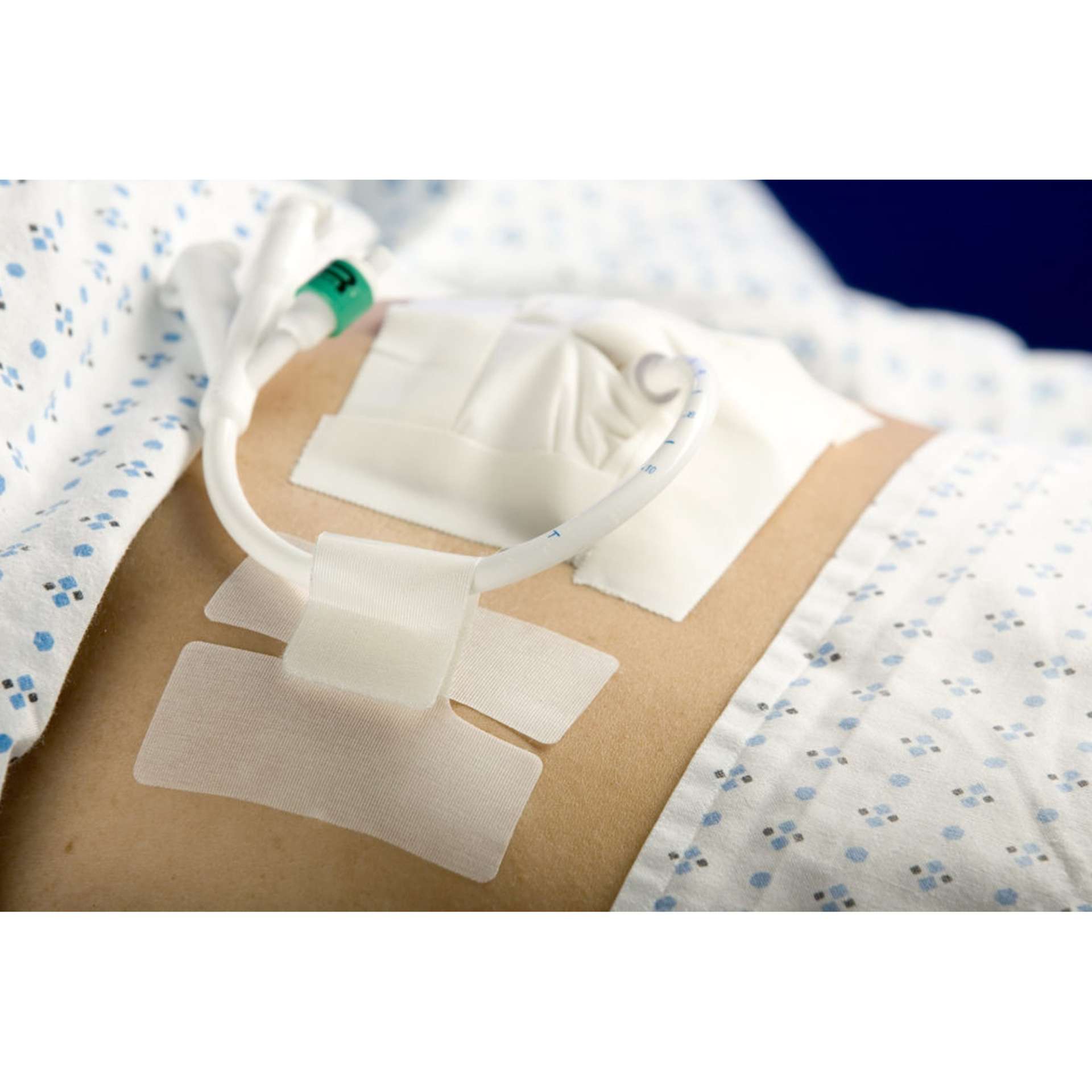 CATH-SECURE, (50/BX)MCJHSN Image
