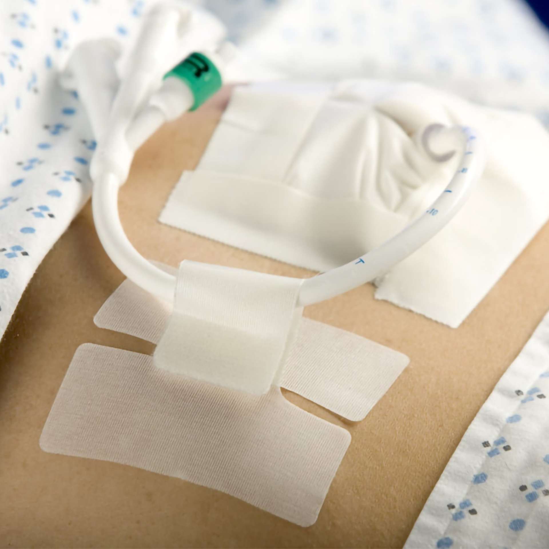 HOLDER, TUBE CATH-SECURE (50/BX 8BX/CS) Image