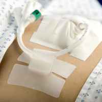 HOLDER, TUBE CATH-SECURE (50/BX 8BX/CS) Image