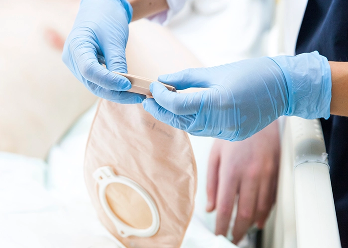 woman holding ostemy bag